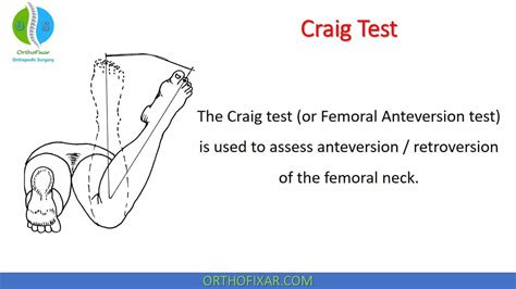 craigs test for torsion angle|what is a craig's test.